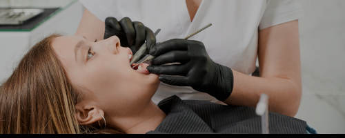 implant dentaire