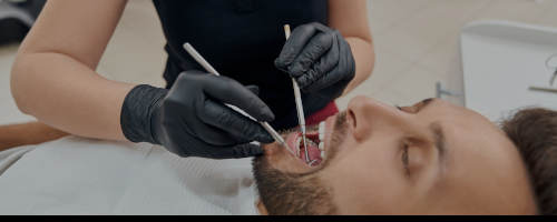 implant dentaire