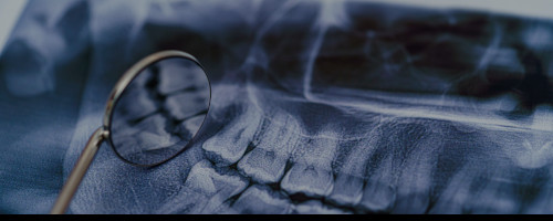 IMPLANT